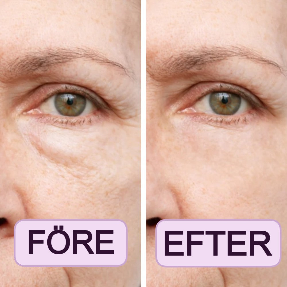 Conceala PRO -  Sluta Applicera Om Var 3:e Timme